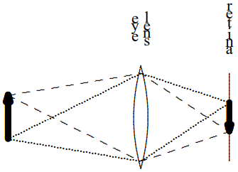 close to your eye lens because the amount of accommodation you can do is limited. If you bring the object too closer than the smallest focal length your eye lens can produce, the real image is beyond your retina, the object will look fuzzy, as shown in [Figure 11.43](#fig-11-43).