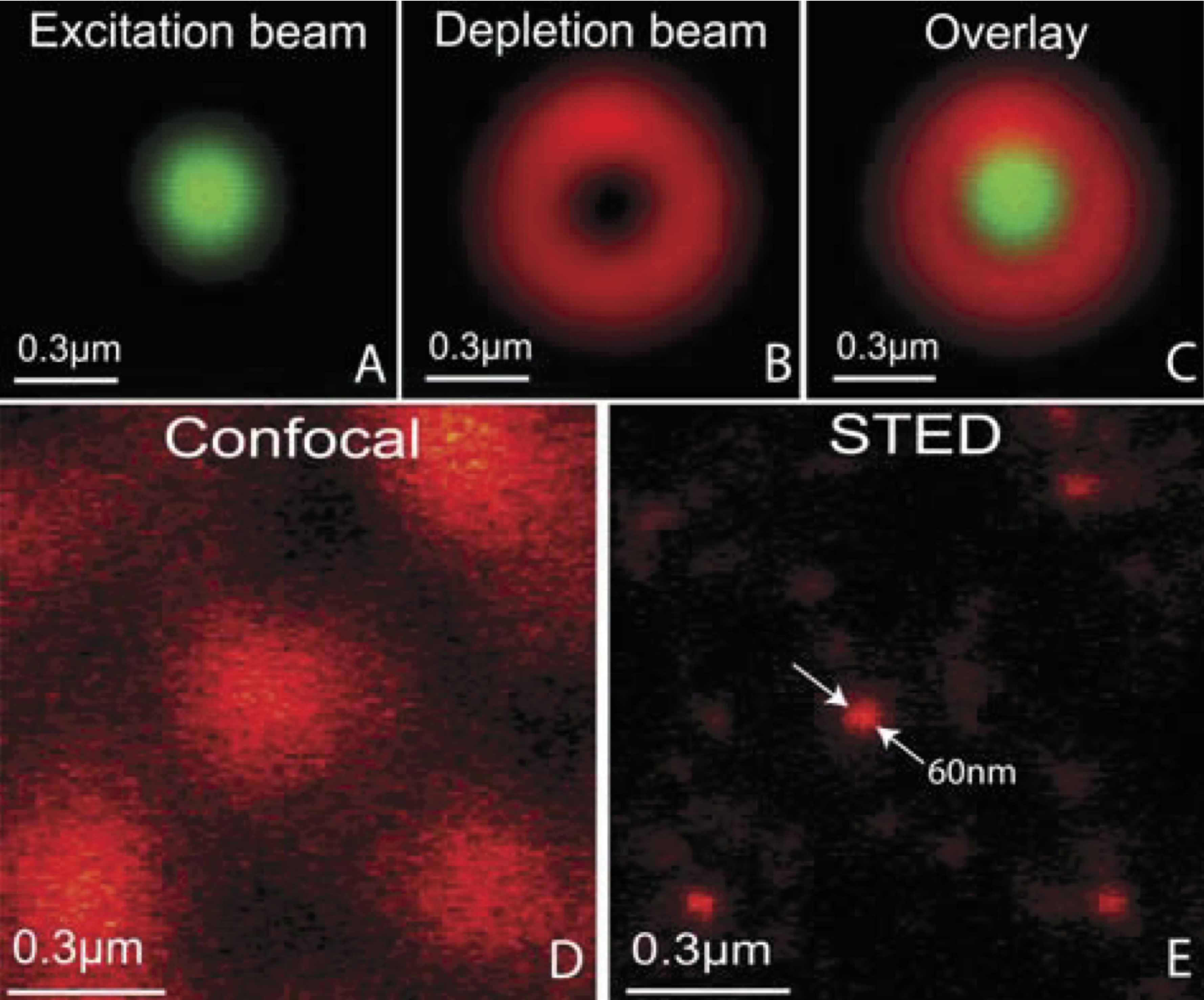 Spot used for excitation (top left) and for depletion (top middle). Fluorescence signal top right.	In the lower figure the confocal image is compared to the STED image. (P.F. Rodriguez and al., Building a fast scanning stimulated emission depletion microscope, Materials Science (2012))