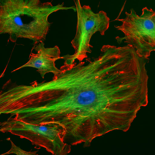 Several cultured cells show red filament networks, green filament bundles, and blue oval nuclei against a black background.